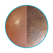 Ohio Hair Loss Solutions | Scalp Pigmentation